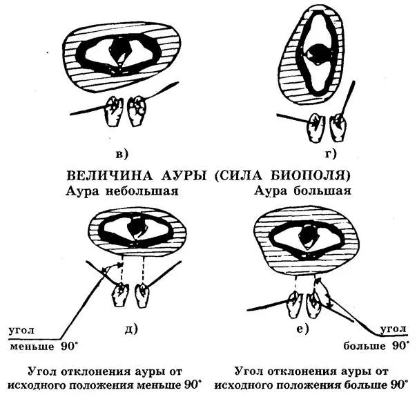 АСИММЕТРИЯ АУРЫ рамки раздвигаются не одинаково Рис 64 Оценка ауры - фото 84