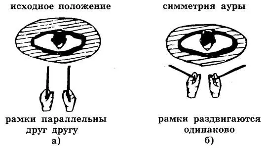 АСИММЕТРИЯ АУРЫ рамки раздвигаются не одинаково Рис 64 Оценка ауры - фото 85