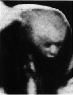 FIG 9 The Haunted Scrotum Face image discovered by Dr Harding PHOTO - фото 10