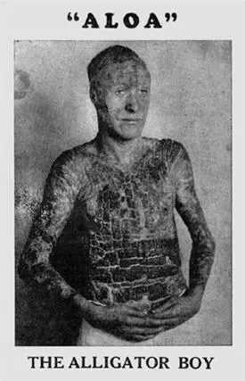 FIG 12 Aloa the unfortunate Alligator Boy AUTHORS COLLECTION Where do - фото 13