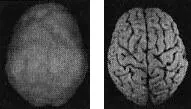 Рис Б показывает трехмерный снимок поверхности здорового мозга вид снизу а - фото 5