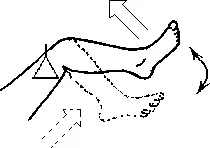 Рис 532 Критический конус в коленном суставе Вариант Б В заключение - фото 153
