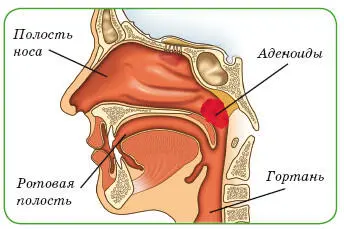 Симптомы Нарушение носового дыхания дети спят с открытым ртом сон часто - фото 1