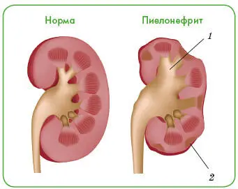 Возбудители энтерококк протей стафилококки стрептококки кишечная палочка - фото 163