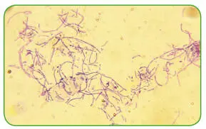 Bacillus anthracis микрофото Сама бактерия сибирской язвы погибает без - фото 189