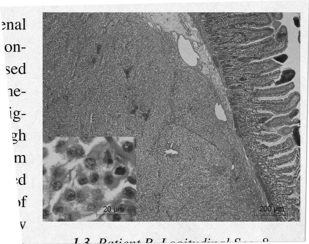 Fig 12 Patient R Longitudinal Section 8 From Fitzgerald T On an - фото 3