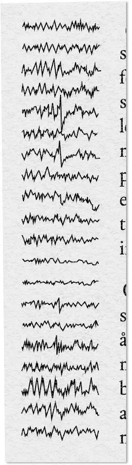 Fig 31 Petit mal 7 From Wolcott D and Henry H Epilepsy - фото 37