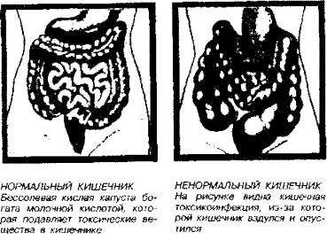 Итак подытожим сказанное кислая капуста превосходный продукт для - фото 1