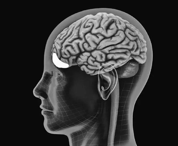 The orbitofrontal cortex sits in the very front of the brain just over the - фото 1