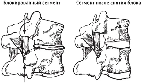 Рис 21Схема снятия блока Такова суть метода мануального лечения заболеваний - фото 26
