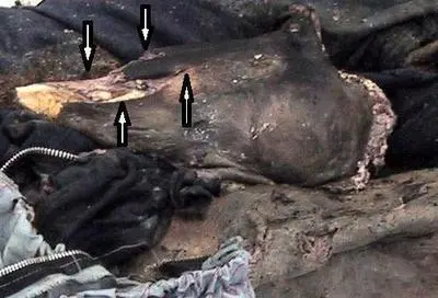 Crescentshaped cuts on Duncans detached knee and top of tibia Destroyed - фото 30