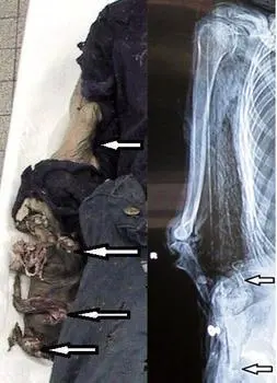 Right arm Bottom arrow indicates where the forearm was severed a few inches - фото 35