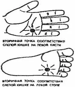 Рис 126 Вторичные точки соответствия аппендиксу на левой кисти и левой стопе - фото 139