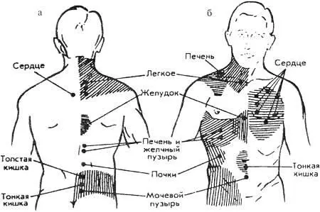 Рис 140 Схематическое изображение проекционных зон внутренних органов на коже - фото 153