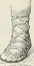 Fig 43a Fig 134 Chaussures grecques pantoufles dont lempeigne - фото 417