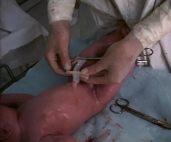 Обработка пуповины Измерение окружности головки Измерение окружности груди - фото 18