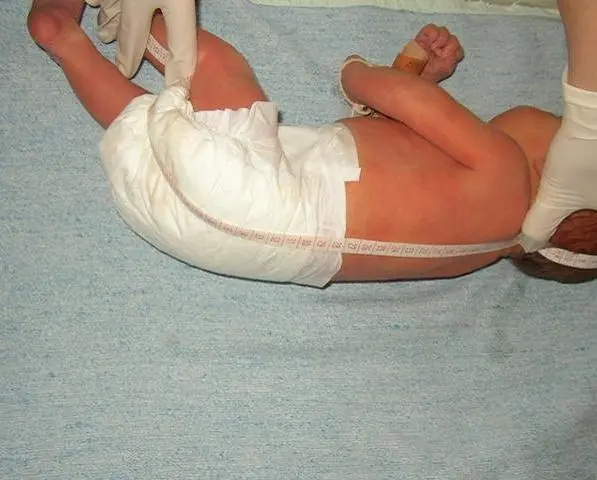 Измерение роста новорождённого Новорожденное дитя выкладывают матери на - фото 21