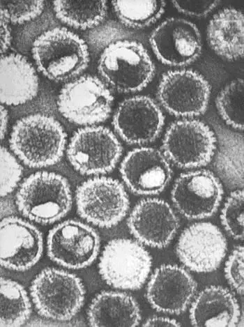 It showed a tight cluster of virions collected from the sediment of her - фото 12