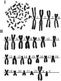 Рис 6 Кариотип человека здорового мужчиныI кариотип общий вид II - фото 7