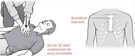 Wrap one hand through the otherand leaning directly over the casualty so you - фото 19