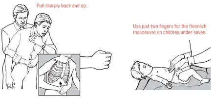 Immobilizing fractures The best way to stop a broken limb moving is to splint - фото 29
