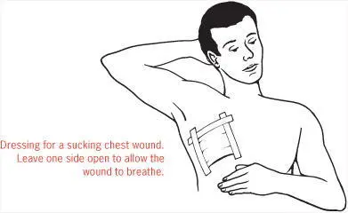 ActionCalm the patient and ask them to hold their hand over the wound to seal - фото 40
