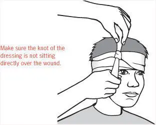 If the casualty is conscious and has no signs of brain injury sit them upright - фото 42