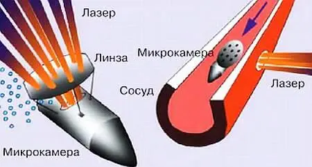 Схема работы микрокапсулы в кровеносной системе человека СЕКРЕТЫ НАШИХ - фото 9