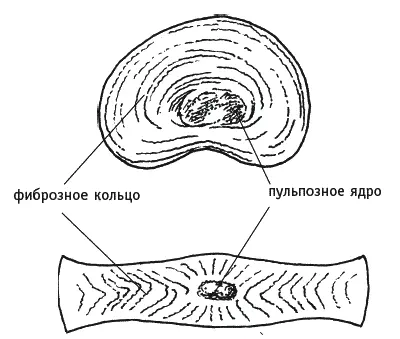 Рис 4 Диск состоит из весьма плотного фиброзного кольца в центре которого - фото 4