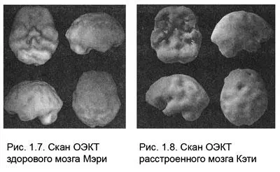 Теоретически резерв мозга примерно одинаков у всех нас и он огромен Но в - фото 7