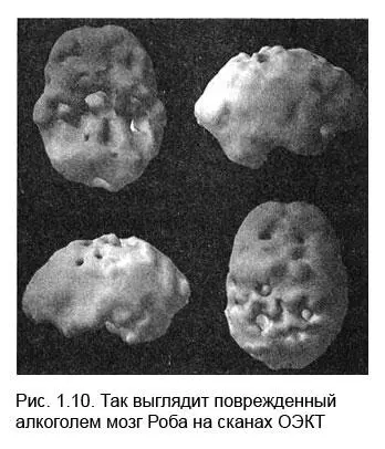 Снимки мозга помогли мне понять в чем были проблемы Роба Они также - фото 9