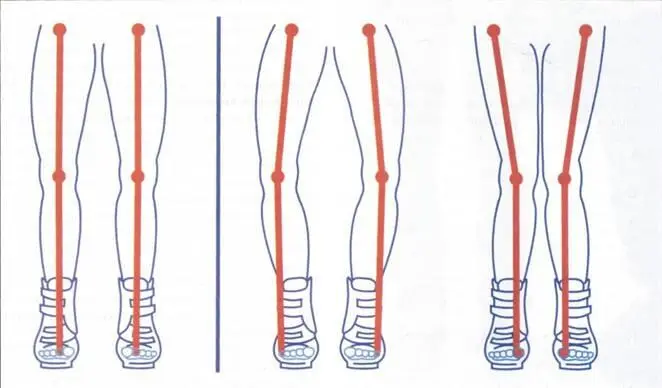 Фото 622 Рисунок слева отображает правильно выровненное положение ног в - фото 191