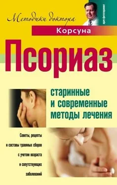 Елена Корсун Псориаз. Старинные и современные методы лечения обложка книги