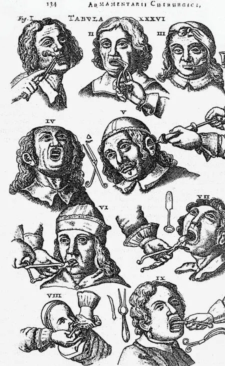 Различные зубоврачебные манипуляции Из книги ТС Сорокиной История - фото 262