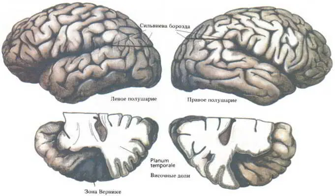 Рис 149 Анатомическая асимметрия полушарий мозга Вверху сильвиева борозда в - фото 172