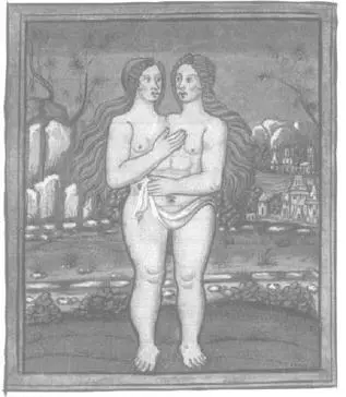 CONJOINED TWINS PARAPAGUS DICEPHALUS DIBRACHIUS NORMANDY FROM PIERRE - фото 7
