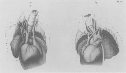 CONJOINED TWINS SITUS INVERSUS VISCERA RITTA AND CHRISTINA PARODI FROM - фото 10