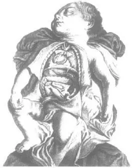 KARTAGENERS SYNDROME DISSECTED INFANT SHOWING SITUS INVERSUS VISCERA FROM - фото 11