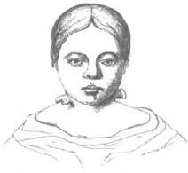 SUPERNUMERARY AURICLES EIGHTYEAROLD GIRL ENGLAND 1858 FROM WILLIAM BATESON - фото 21