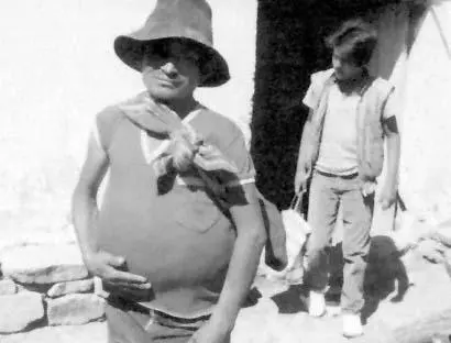 Figure 9 Peasant from the Department of Sucre Bolivia with enlarged colon - фото 9