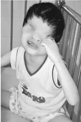 Girl born without eyes Duc enters the room in a wheelchair and we talk - фото 20