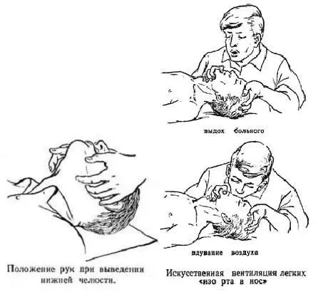 Стандартный комплекс неотложной ИТ включет 3 компонента 1 восстановление - фото 3