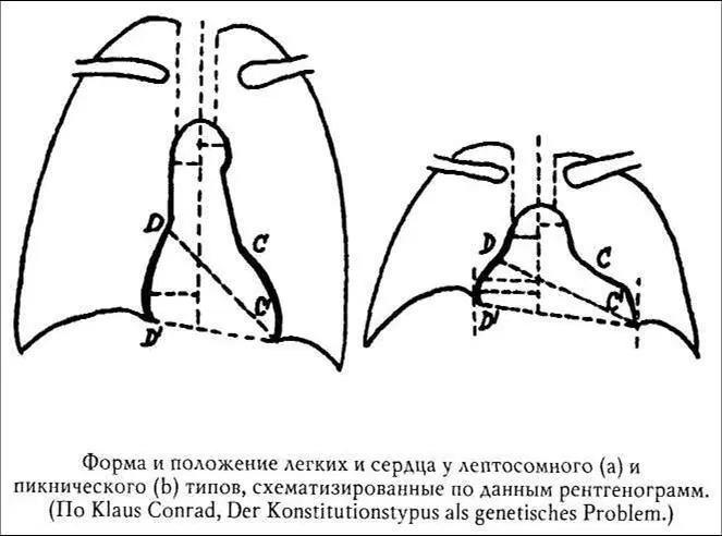 Конституция это результат развития За первоначально скругленными формами - фото 24