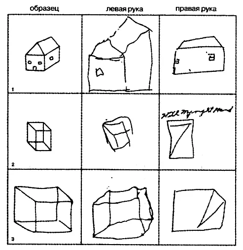 Рис 2Рисунки пациентов с расщепленным мозгом по The Split Brain in Man - фото 2