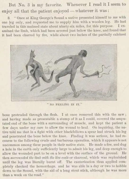 But he was a fastidious native He soon discarded the wooden leg made for him - фото 59