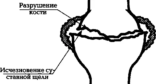 Илл 2в 3я стадия артроза Ведь даже если предположить что какимлибо - фото 4