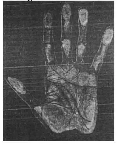 Рука самоубийцы Сравните эту руку с ладонью доктора Мейера отпечаток которой - фото 27