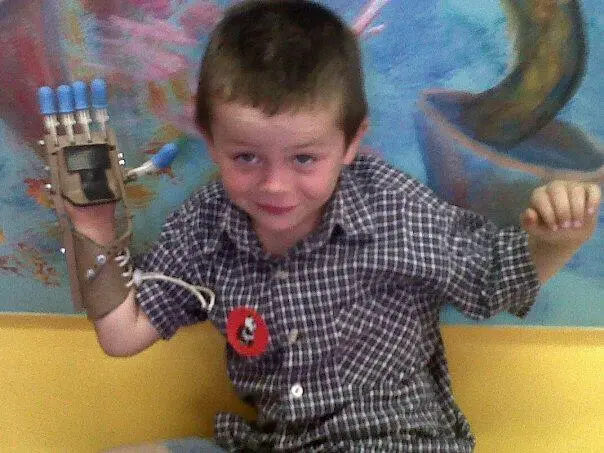 Протез Robohand и его маленький счастливый пользователь потерявший пальцы на - фото 114