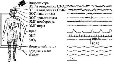ПолисомнографияВ лаборатории сна врачи измеряют электрическую активность - фото 2