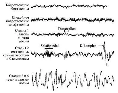 Десять секунд из пяти типичных ЭЭГ различных состояний сна и бодрствования - фото 3